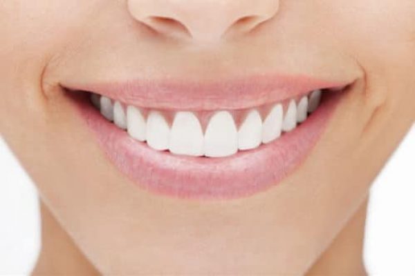 cosmetic-dental-bonding-adentaloffice cosmetic-dental-bonding-adentaloffice