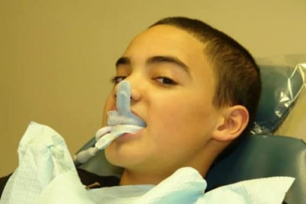 dental-sealants-and-flouride-treatments-adentaloffice dental-sealants-and-flouride-treatments-adentaloffice
