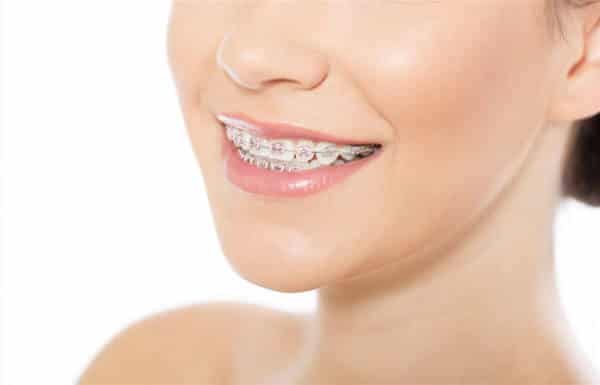 orthodontics-adentaloffice orthodontics-adentaloffice