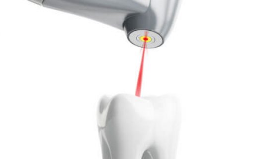 periodontal-therapy-adentaloffice periodontal-therapy-adentaloffice