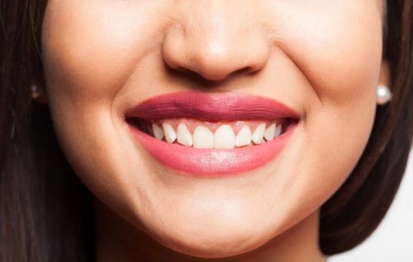 smiling-face-gum-disease-adentaloffice smiling-face-gum-disease-adentaloffice