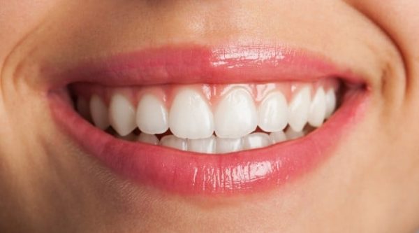 teeth-whitening-adentaloffice teeth-whitening-adentaloffice