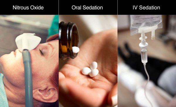 sedation-adentaloffice sedation-adentaloffice