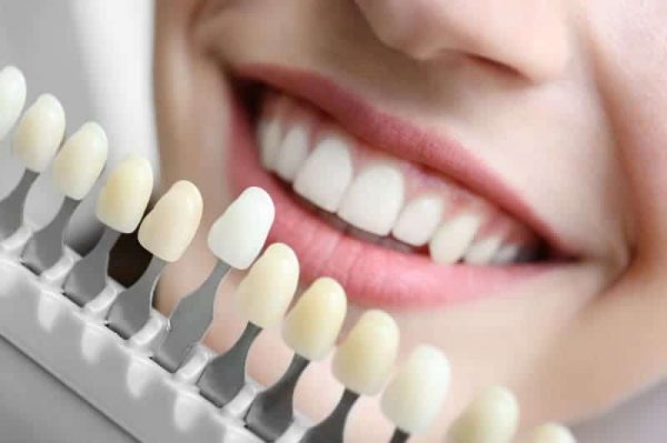 teeths-shade-guide-adentaloffice teeths-shade-guide-adentaloffice