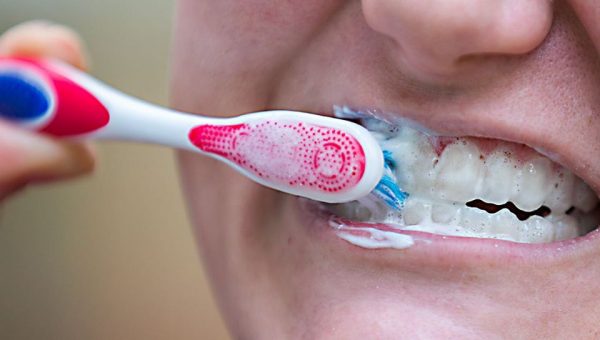 aggresive-tooth-brushing-adentaloffice aggresive-tooth-brushing-adentaloffice